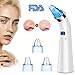 Blackhead Remover - XFJ Blackhead Vacuum Cleanser With 4 Removable Probes LED Display Rechargeable Blackhead Removal Tool Come With USB Charging Cable