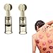 Vacuum Cupping Multi-Functional Rotary Magnetic Therapy Cupping Device Relax Biomagnetic Chinese Cupping Therapy Set 2PCS(S)
