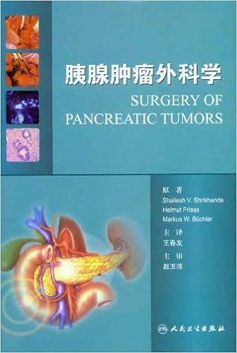 Pancreatic Cancer Surgery Translated Version Chinese Edition Yin Shi Rui Ke Han De Wang Chun You Zhu 9787117125109 Amazon Com Books
