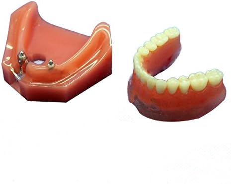 Dental Study Teaching Model Teeth Implant Repair Model For Dentist