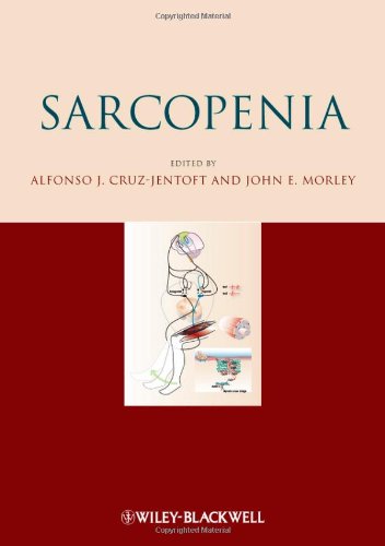 Sarcopenia