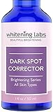 Dark Spot Corrector Best Dark Skin Age Spots Removal for Face, Hands, Body No Hydroquinone 1 ounce