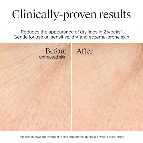 NEUTROGENA HYDRO BOOST GEL CREAM FRAGRANCE FREE, HYALURONIC ACID FACIAL MOISTURIZER FOR NORMAL TO DRY SKIN, DELIVERS HYDRATION FOR NOURISHED, DEWY SKIN, 1.7 FL. OZ