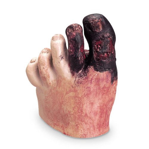Nasco WA21216 Life/Form Unhealthy Foot Care Kit