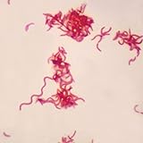 Gram-Negative Spirillum, w.m. Gram Stain Microscope Slide