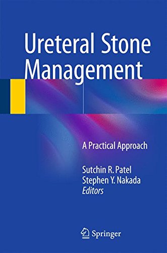 Download Ureteral Stone Management: A Practical Approach