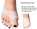 Foots Love – Bunion Splints – Bunions Toe Straightener, Overlapping Toes. Straighten Pad and Comfort Big Toe Pain.