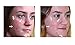 Omiera Adroit Natural Facial, Body, Bikini, And Legs Hair Growth Inhibitor Cream and Acdue Acne Scar Removal Cream, Severe Acne Spot Treatment, Acne Dark Spot Corrector Kit
