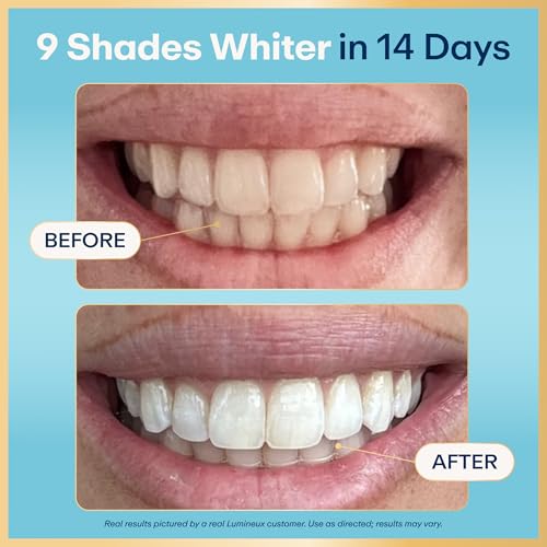 Lumineux 10% Nano Hydroxyapatite Performance Whitening Toothpaste - Fluoride Free & Gentle Whitening - Clinically Supported & NASA-Developed nHA for Strong Enamel & Bright, Smooth Teeth (3.75 oz)