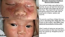 Mongdies Double Ato Cream set