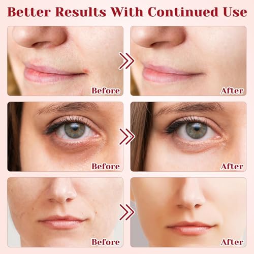 Dragon's Blood Cream, Retinol Placenta Dragon's Blood Creams, Moisturizing Cream, Makes The Skin Firm, Plump, Smooth, Moisturizing, Suitable for Women's Skin Care