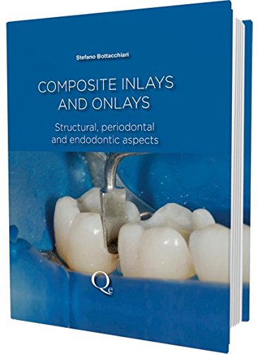 Download Composite Inlays and Onlays: Structural, Periodontal, and Endodontic Aspects Download Composite Inlays and Onlays: Structural, Periodontal, and Endodontic Aspects