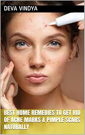 best home remedy for pimples and pimple marks