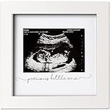 Baby Sonogram Picture Frame - Modern Ultrasound