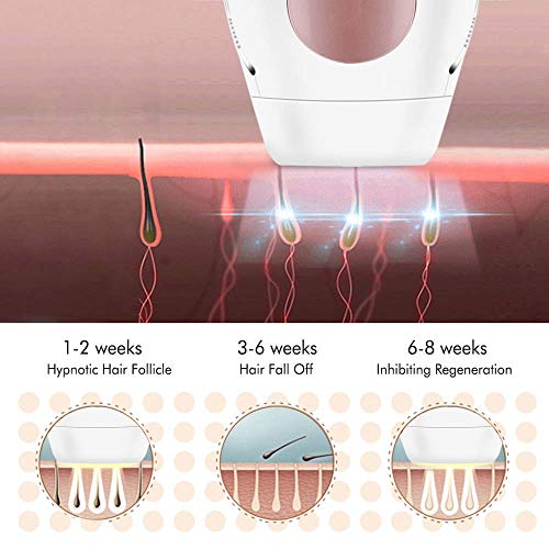 Bosidin Permanent Hair Removal Facial & Body Hair Removal for Women and Men Home Use, 400,000 Flashes Professional IPL Hair Removal System - Thumbnail 4