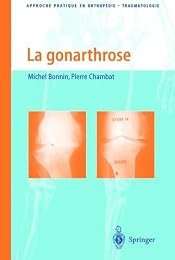 La  gonarthrose