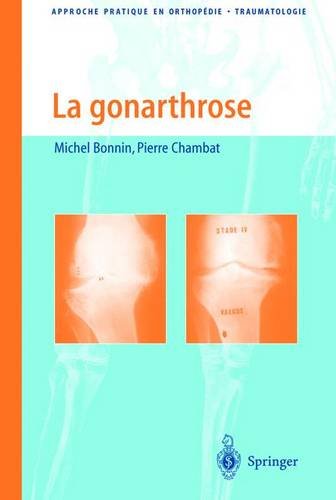 La  gonarthrose
