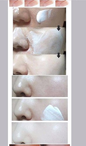 Special Promotion!korean Best Unisex Chaldduk Natural Whitening Skin Tone Perfecting Cream with Snail Mucus Extract, Lighten Stubborn Dark Spots, Freckles,skin Discoloration , Pimples, Acne Scars, Balance Pigmentation, Prevent Acne - 100g.usa Seller Special Promotion!korean Best Unisex Chaldduk Natural Whitening Skin Tone Perfecting Cream with Snail Mucus Extract, Lighten Stubborn Dark Spots, Freckles,skin Discoloration , Pimples, Acne Scars, Balance Pigmentation, Prevent Acne - 100g.usa Seller