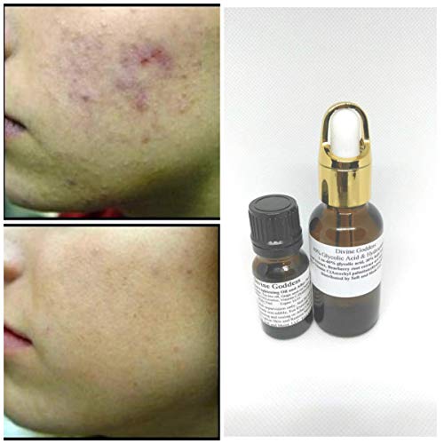 Buy Glycolic 40 Peel Facial Peel Contains Glycolic Retinol C Kojic