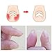 ZHUOTOP 10pcs Ingrown Toenail Straightening Clip Curved Brace Toenails Thick Paronychia Correction Tool 4mm