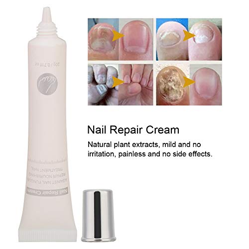 Nail Repair Cream, 20ML Nail Cream Repair, Nail Strengthener, Finger Toe Nail Care Cream for Men and Women Home Use