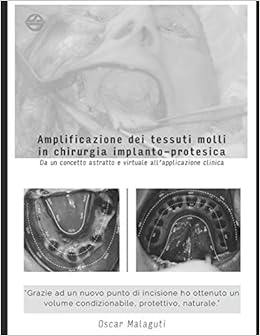 Amazon It Amplificazione Dei Tessuti Molli In Chirurgia Implanto Protesica Da Un Concetto Astratto E Virtuale All Applicazione Clinica Un Atteggiamento Chirurgico Diverso Offre Risultati Differenti Malaguti Dott Oscar Malaguti Dott Oscar Libri