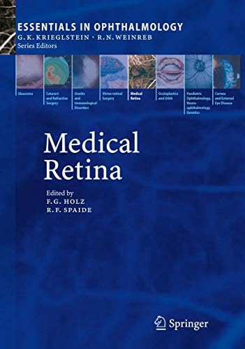 Glaucoma: 2-Volume Set: 9780702051937: Medicine & Health Science