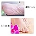 Foot File, Double Side Callus Remover for Feet, Pedicure Foot Scraper Tool, Professional Foot Rasp Eliminate Cracked Dead Thick Dry Hard Skin