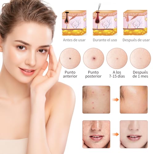 Pluma de Plasma, 15 Niveles, Dispositivo de Cuidado Facial con Tecnología de Plasma, USB Recargable, Pantalla LED, Compacto para Uso Personal y Profesional (Blanco Perla)