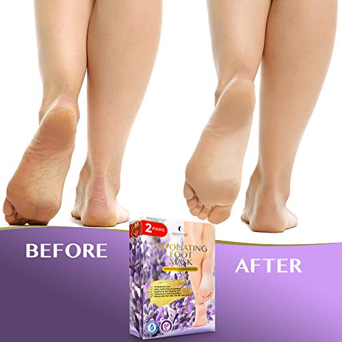 Foot Peel Mask 2 Pack Peeling Away Calluses and Dead Skin cells Make Your Feet Baby Soft Exfoliating Foot Mask Repair Rough Heels Get Silky Soft Feet