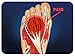 Pro-Tec Metatarsal Pad, Medium, Forefoot Support, Metatarsalgia Pain Relief, Foot Support, Ball of Foot Support, Men & Women, Pain Relief, Easy to Use, Working Out