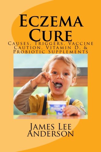 Eczema Cure: Causes, Triggers, Vaccine Caution, Vitamin D, & Probiotic Supplements