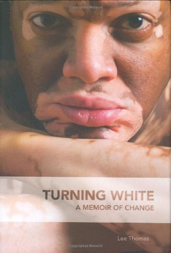 Turning White A Memoir Of Change Thomas Lee Amazon De Bucher