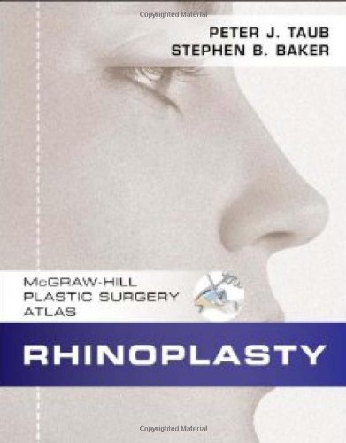 RHINOPLASTY