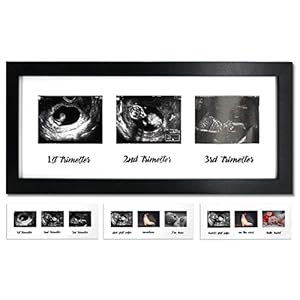 IHEIPYE Triple Sonogram Pregnancy Frame – Baby Ultrasound Picture Frame with Story for Expecting Parents, Baby Shower…
