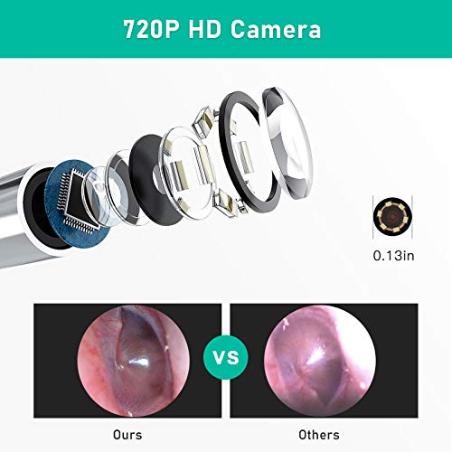 3.5mm USB Otoscope Ear Scope Camera - WETDCQ Waterproof HD Visual Ear Endoscope Ear Camera with Earwax Cleaning Tool, 6 Adjustable LED Lights and 3-in-1 Connector for Android and Windows