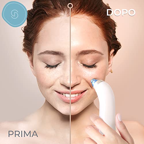 Essy Blackhead Aspirator Blackhead Remover Profesional Nose Extractor Machine Aspirator Pimple Cleaning Face Squeeze Remover Blackhead Remover Blackhead Remover