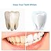 Teeth Whitening Strips, Fixget 28 Pieces 3D Teeth Stain Remover, Mint Flavor Freshen Breath, 14 Treatment, 30 Minutes Express, Non-Slip Tooth Bleaching Gel Strip for Sensitive Teeth