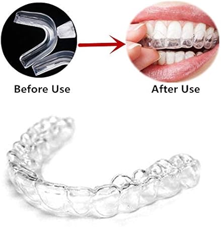 Lizongfq 2pcs Pour L Alimentation Silicone De Qualite Orthodontie Appareil Dentaire Dents Transparent Blanchissant Beaute Outil Approprie Pour Dentier Disque Amazon Fr Cuisine Maison