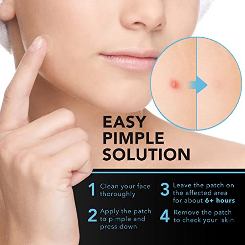 KEYCONCEPTS Acne Patches (120 Count) with Tea Tree Oil, Hydrocolloid