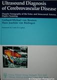 Ultrasound Diagnosis of Cerebrovascular Disease : Doppler Sonography of the Extra and Intracranial Arteries, Duplex Scanning, Reutern, Gerhard-Michael Von and Budingen, Hans Joachim Von, 3137844010