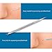 Blackhead Remover Extractor Removal Tool Tweezers Kit, Blemish Pimple Comedone Acne Whitehead Remover Removal Tool Set, 2 PCS