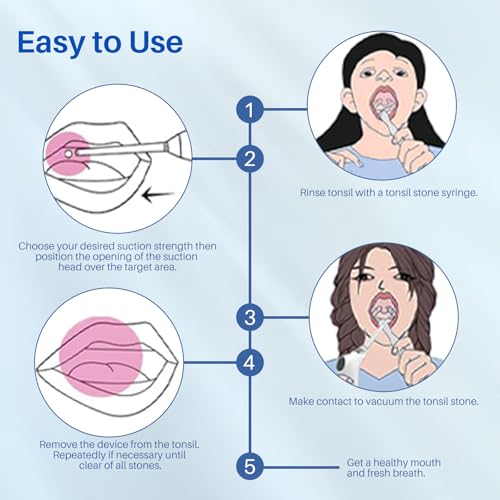 Vhipu Electric Tonsil Stone Remover Set, Quickly Remove Almond Stones, Almond Stones Cupping Glass, Fight Bad Breath for Convenient and Suitable for Use at Home and Travel