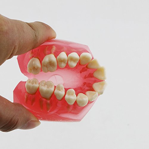 5 Dentalmall%25C2%25AE+Dental+Demonstration+teeth+Model