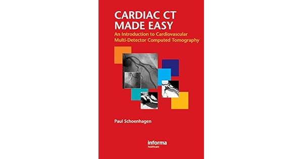 Amazon.com: Cardiac CT Made Easy: An Introduction to ...