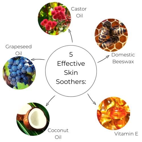 Ora's Amazing Herbal, Touchy Skin Salve, Eczema Cream Treatment, Anti-Itch Cream for Kids and Adults, Calendula Ointment for Natural Sensitive, Fragrance Free, Dry Skin Balm 1 oz Travel Size