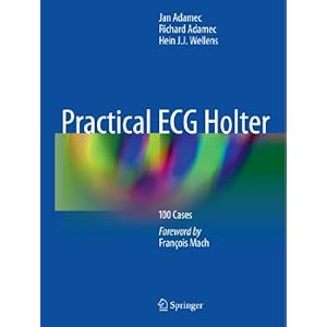 Practical ECG Holter: 100 Cases