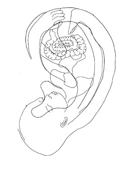 online метаболический синдром