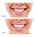 TrueWhite Teeth Whitening Pen - Active Oxygen & Carbamide Peroxide, 30+ Treatments, 4ML, Zero Sensitivity & Professionally Formulated