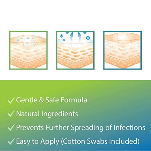 3 Strength+Painlessly+Infections+Advanced+Evagloss